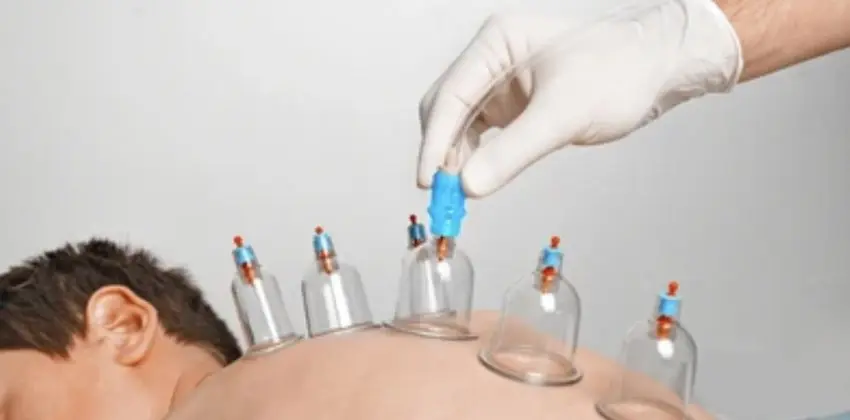 Hijama-Institut