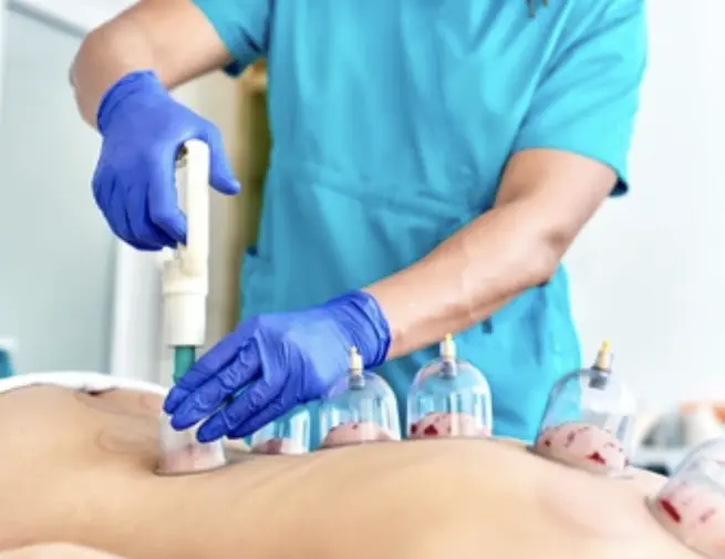 Hijama-Institut