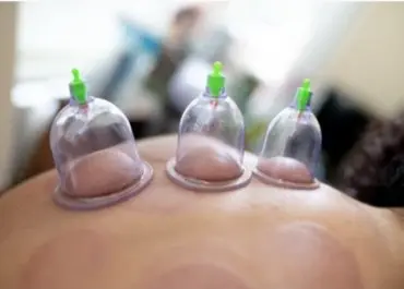 Hijama-Institut